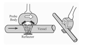 Working Principle of Ultrasonic Flow Meter